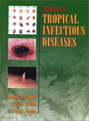 Essentials of Tropical Infectious Disease